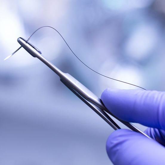 Surface Characterization of Antibacterial Coated Sutures - EAG Laboratories